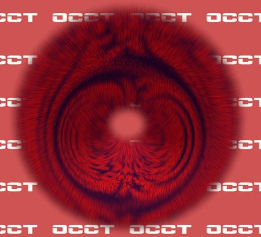 окно теста OCCT окно теста OCCT